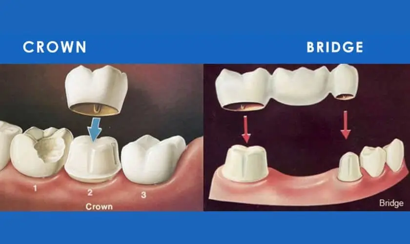 Kind-Family-Dentistry-week-3-1