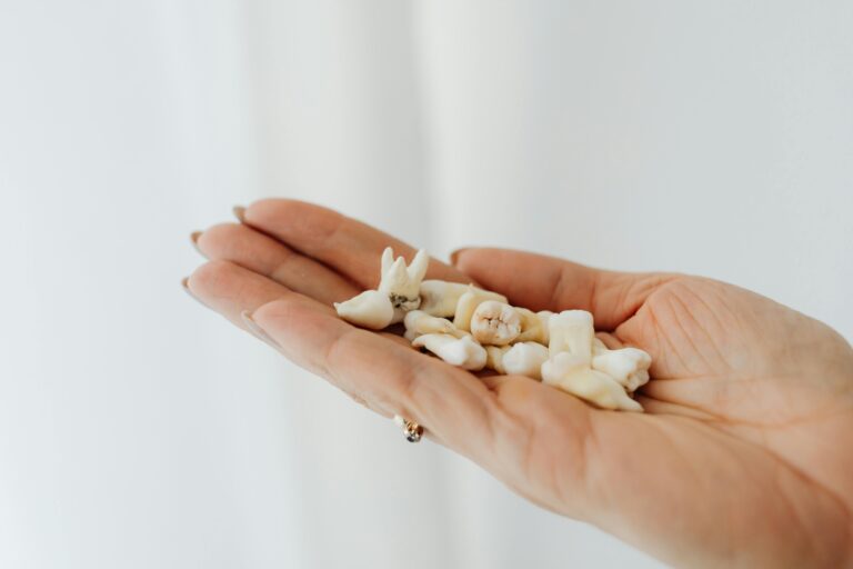 Tooth Extraction Treatment: Safe Removal of Damaged Teeth